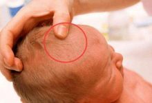 如何通過囟門判斷寶寶的健康-寶寶俱樂部